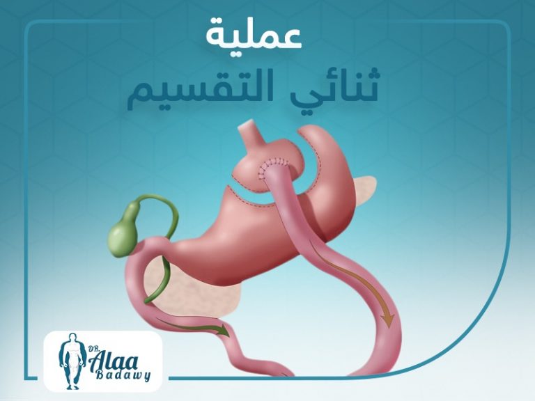 عملية ثنائي التقسيم