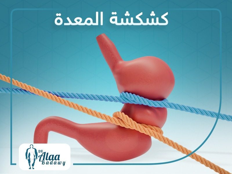 عملية كشكشة المعدة