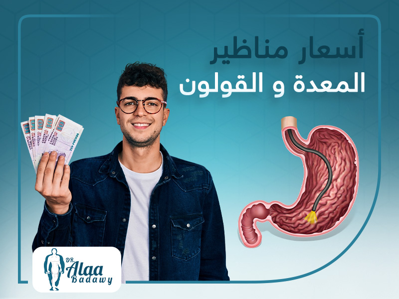 أسعار مناظير المعدة والقولون