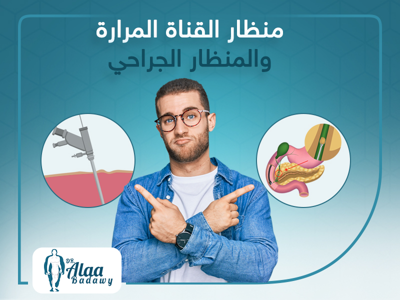 الفرق بين منظار القناة المرارية و المنظار الجراحي