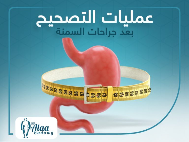 عمليات التصحيح بعد جراحات السمنة