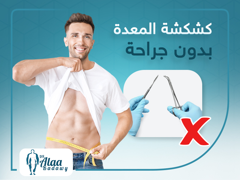 عملية كشكشة المعدة بدون جراحة