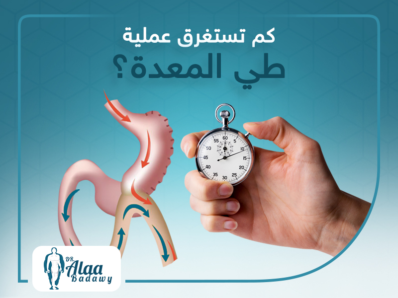 كم تستغرق عملية طي المعدة